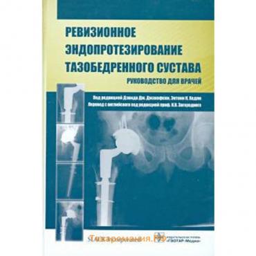 Ревизионное эндопротезирование тазобедренного сустава. Руководство для врачей