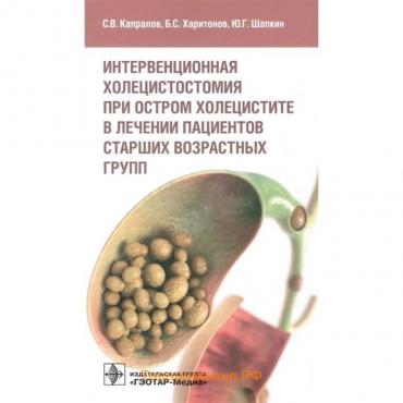 Интервенционная холецистостомия при остром холецистите в лечении пациентов старших возрастных групп
